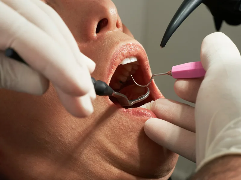 Tandhygienist
